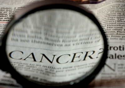 महिलाओं में स्तन कैंसर से होने वाली मृत्यु दर को कम कर सकती है ‘मास्टेक्टॉमी’ सर्जरी