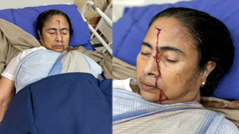 सीएम ममता बनर्जी को गंभीर चोट लगी, अस्पताल में भर्ती