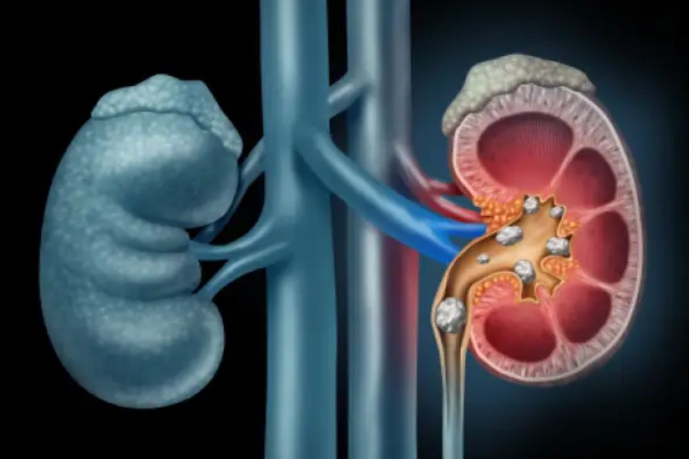 Kidney
