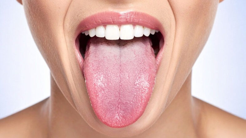 हल्के में न ले सफेद जीभ की परेशानी