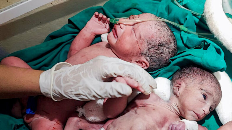 प्रगति क्यों धीमी हुई?