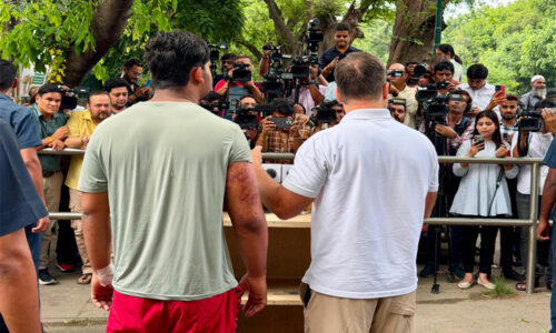 पैलेट गन से घायल छात्र को साथ लाकर राहुल ने सरकार पर साधा निशाना